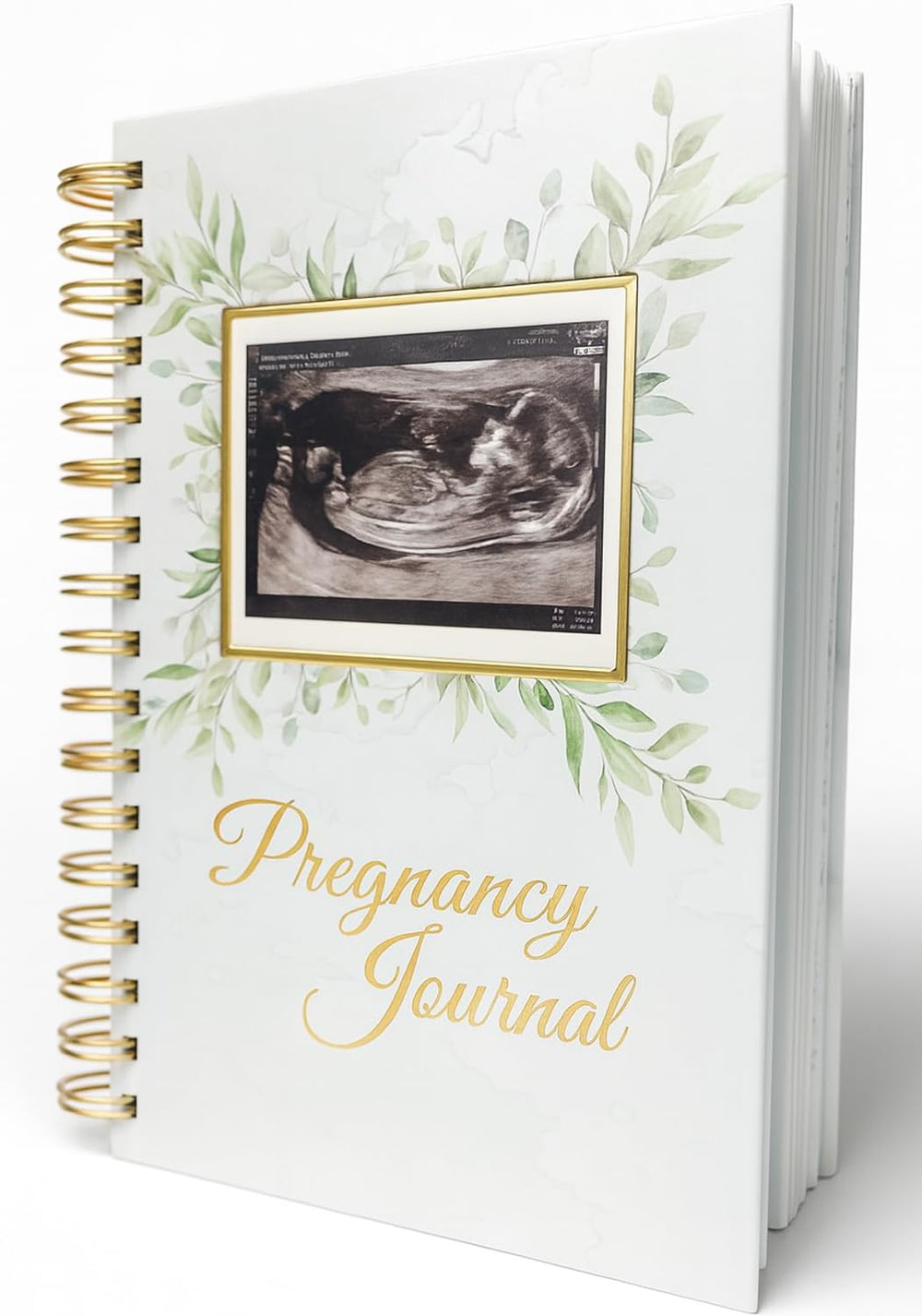 Forever Lily pregnancy journal hardcover with ultrasound window for cherished memories.