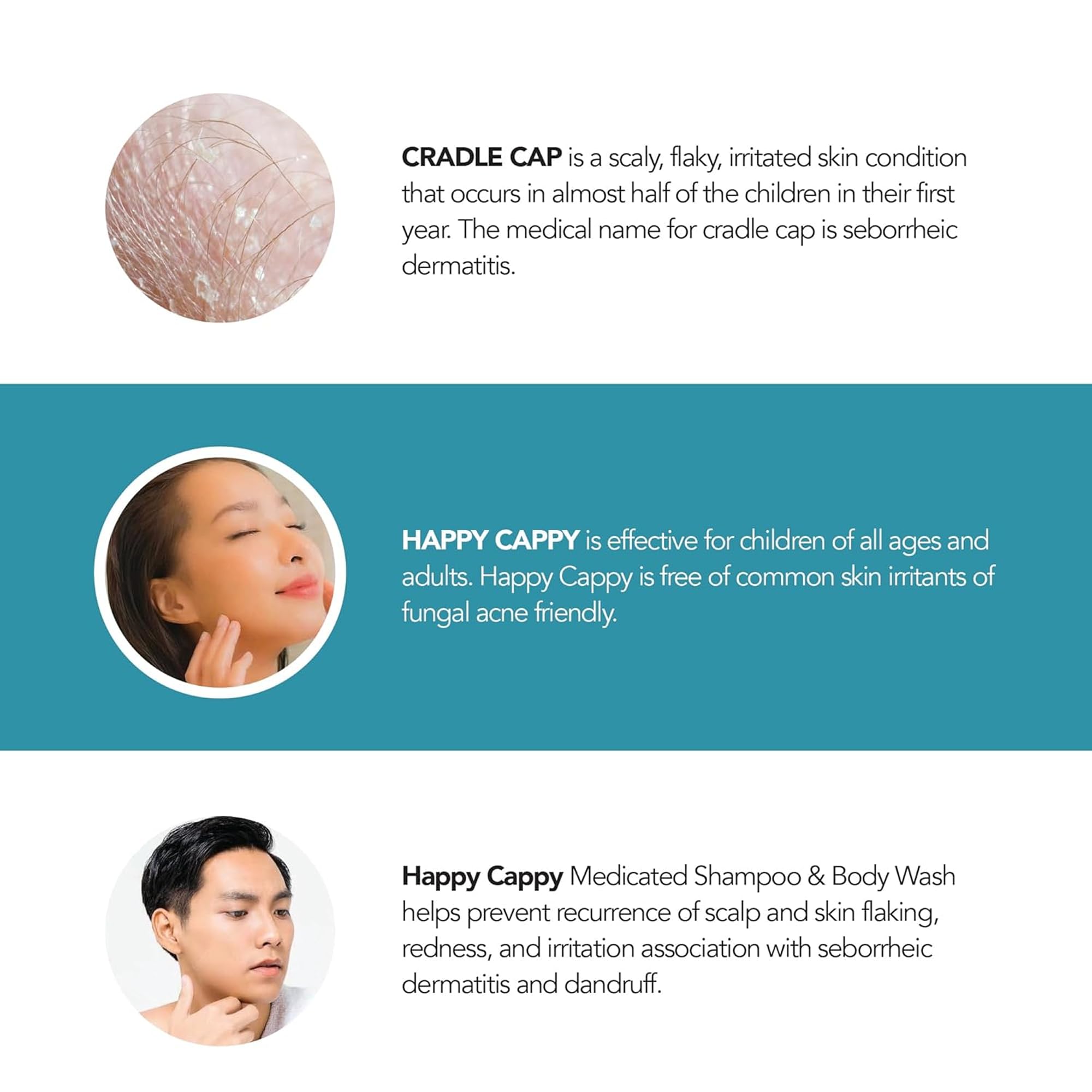 Happy Cappy Medicated Shampoo scene showing scalp care and flakes.