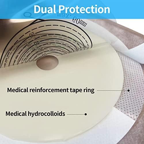 Stoma measurement card helps precisely size the opening