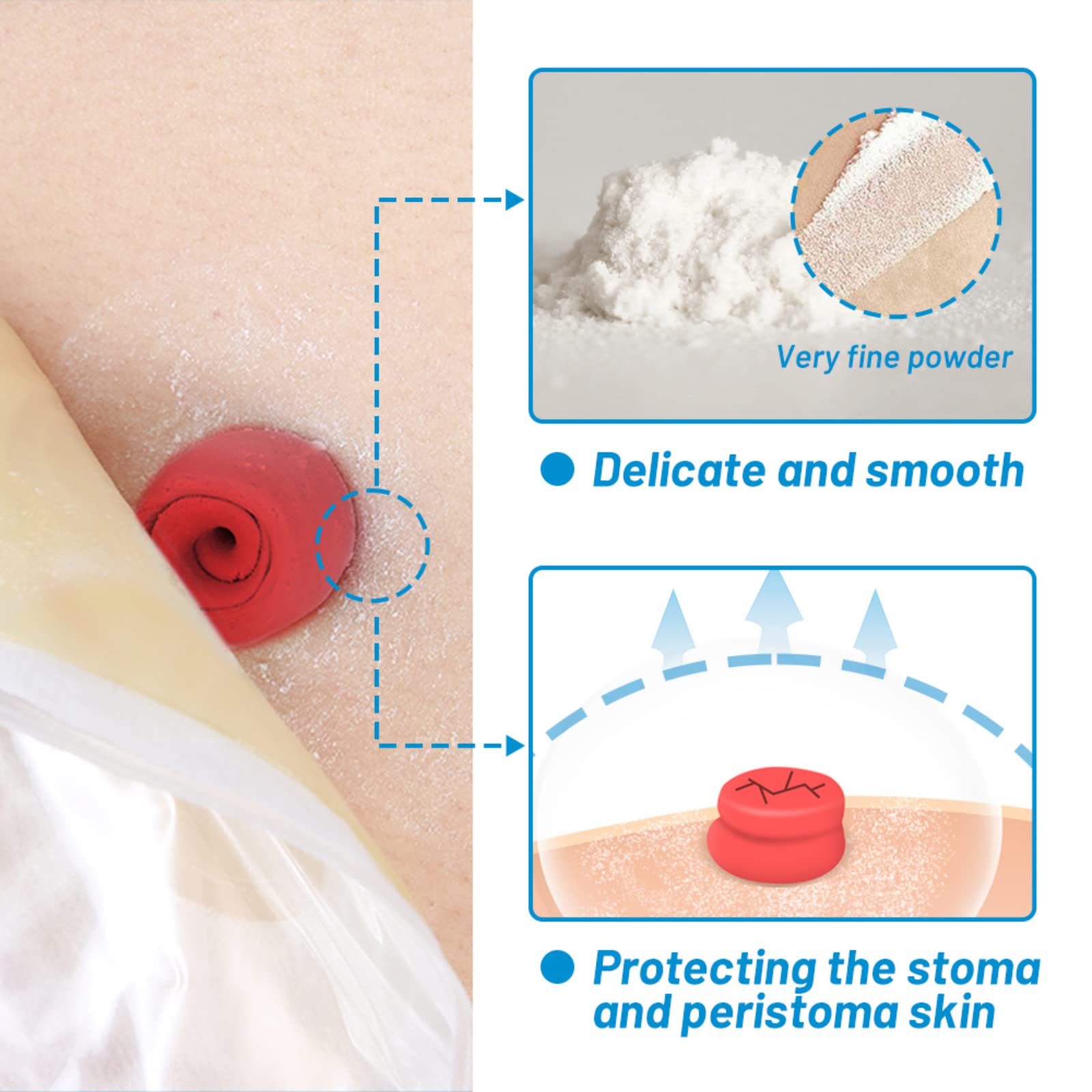 Heagimed stoma powder shown with fine texture for gentle protection around the stoma.