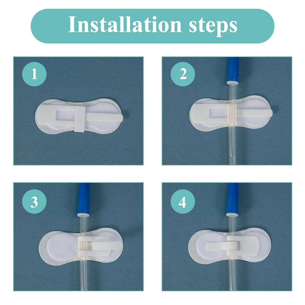 HNYG catheter stabilization device anchors tubes to reduce movement.