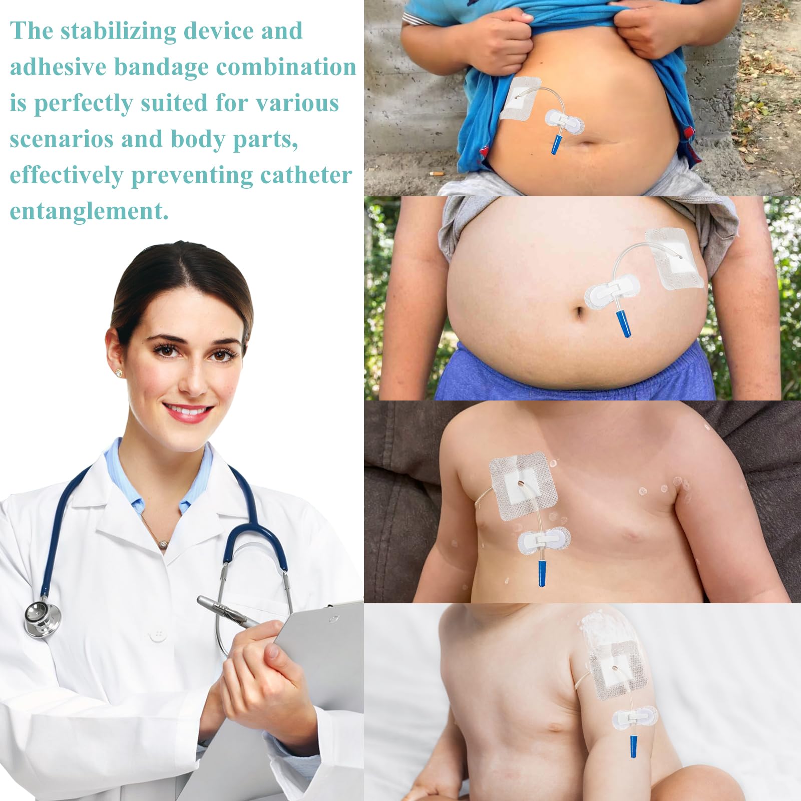 HNYG feeding tube supplies bundle provides organized care essentials.