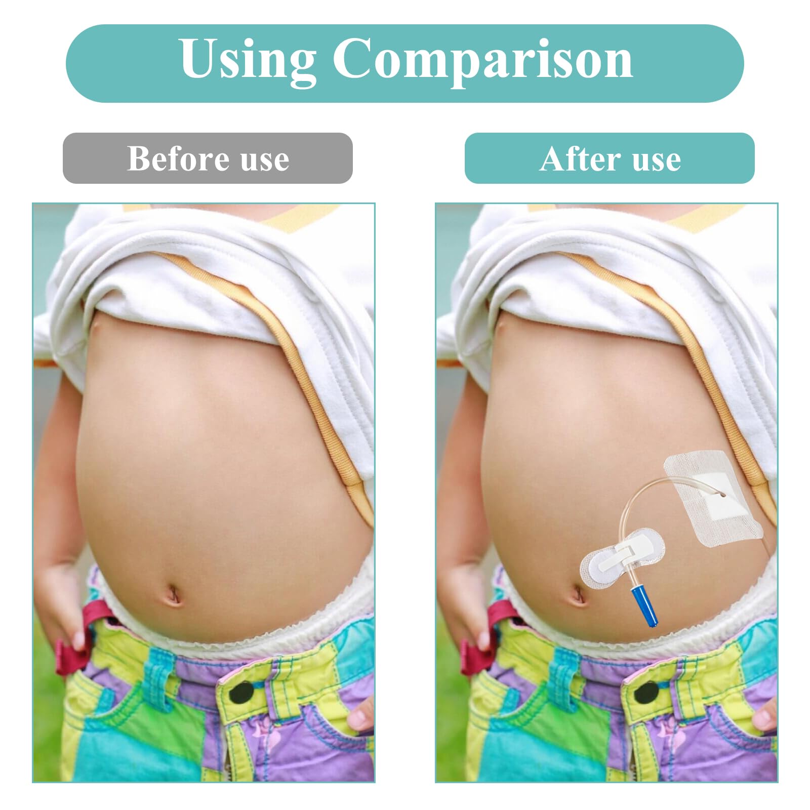 HNYG self adhesive patch dressing adheres quickly for reliable protection.