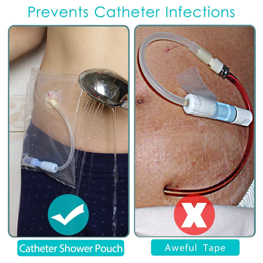 Hola Health gtube-feeding-tube-cover shields the tube from splashes.