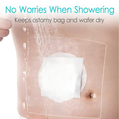 Hola Health transparent stoma cover dries the area without sticking to the pouch.