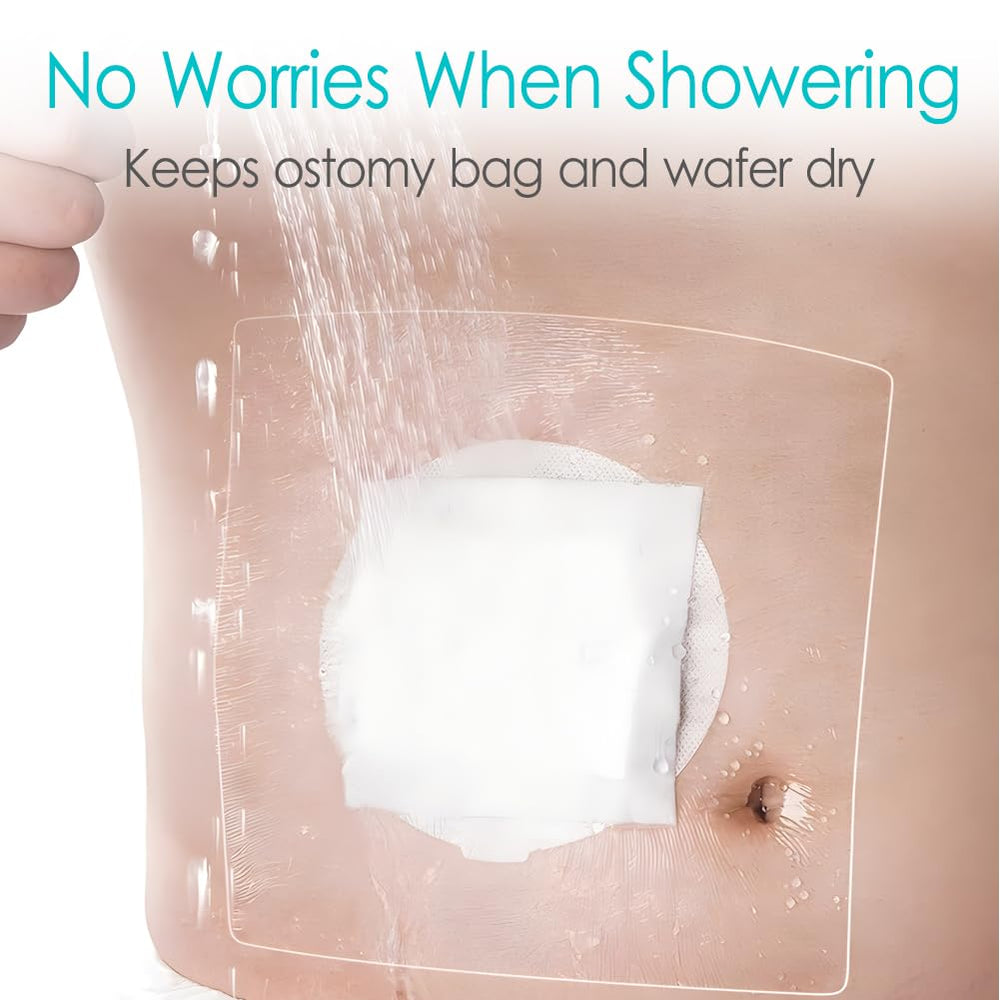 Transparent stretch adhesive bandage covers around the stoma clearly.