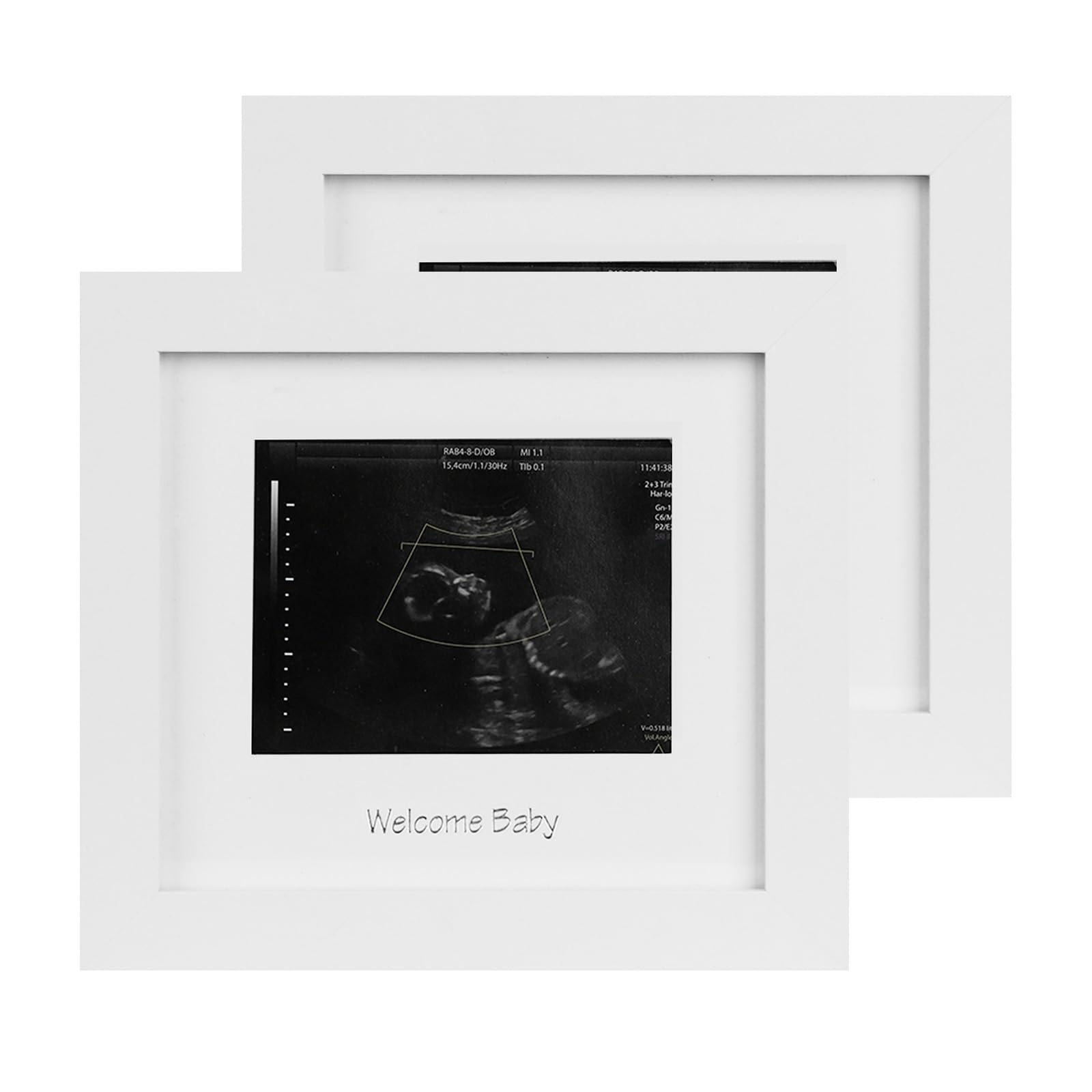 IHEIPYE baby sonogram frame with silver text for nursery display.