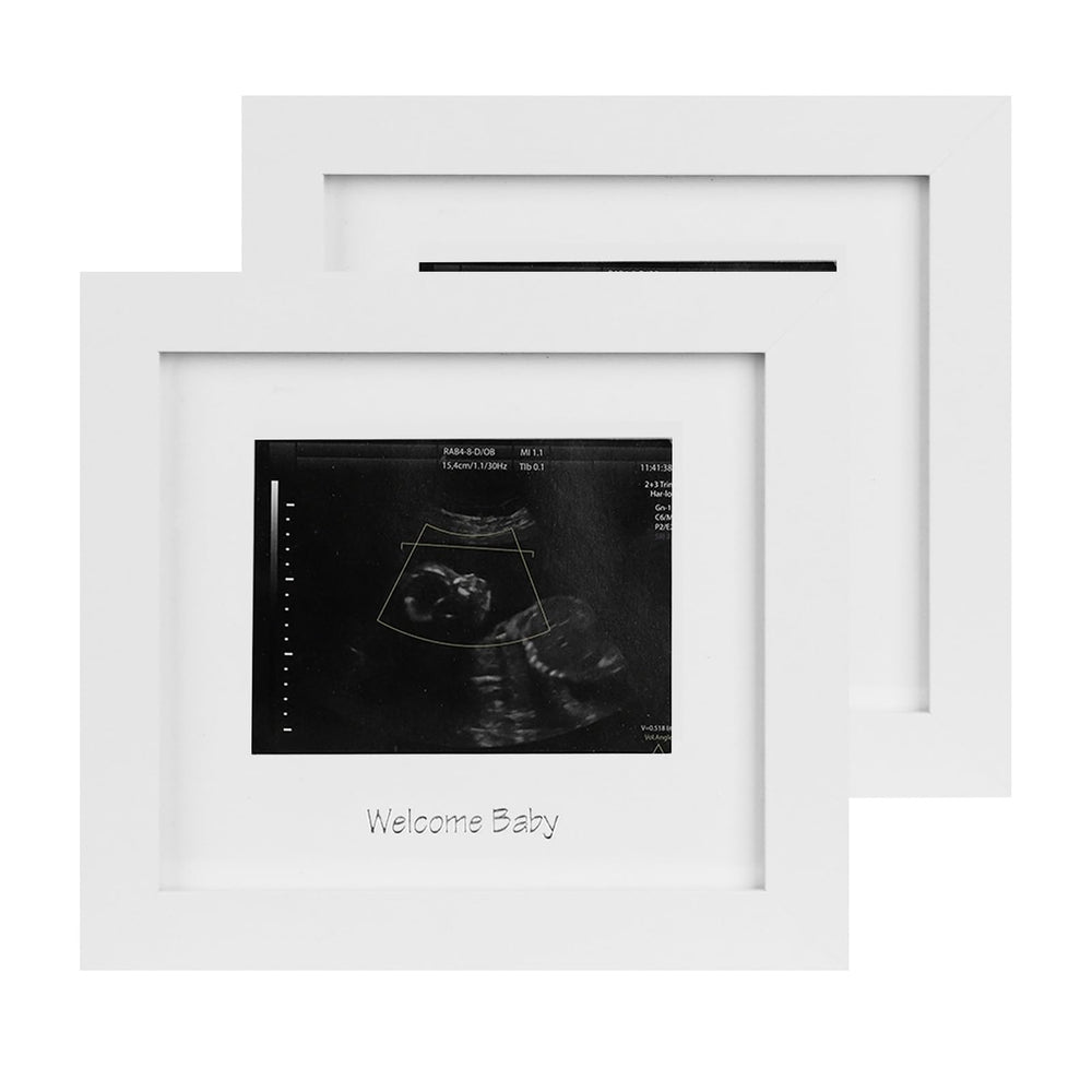 IHEIPYE baby sonogram frame with silver text for nursery display.