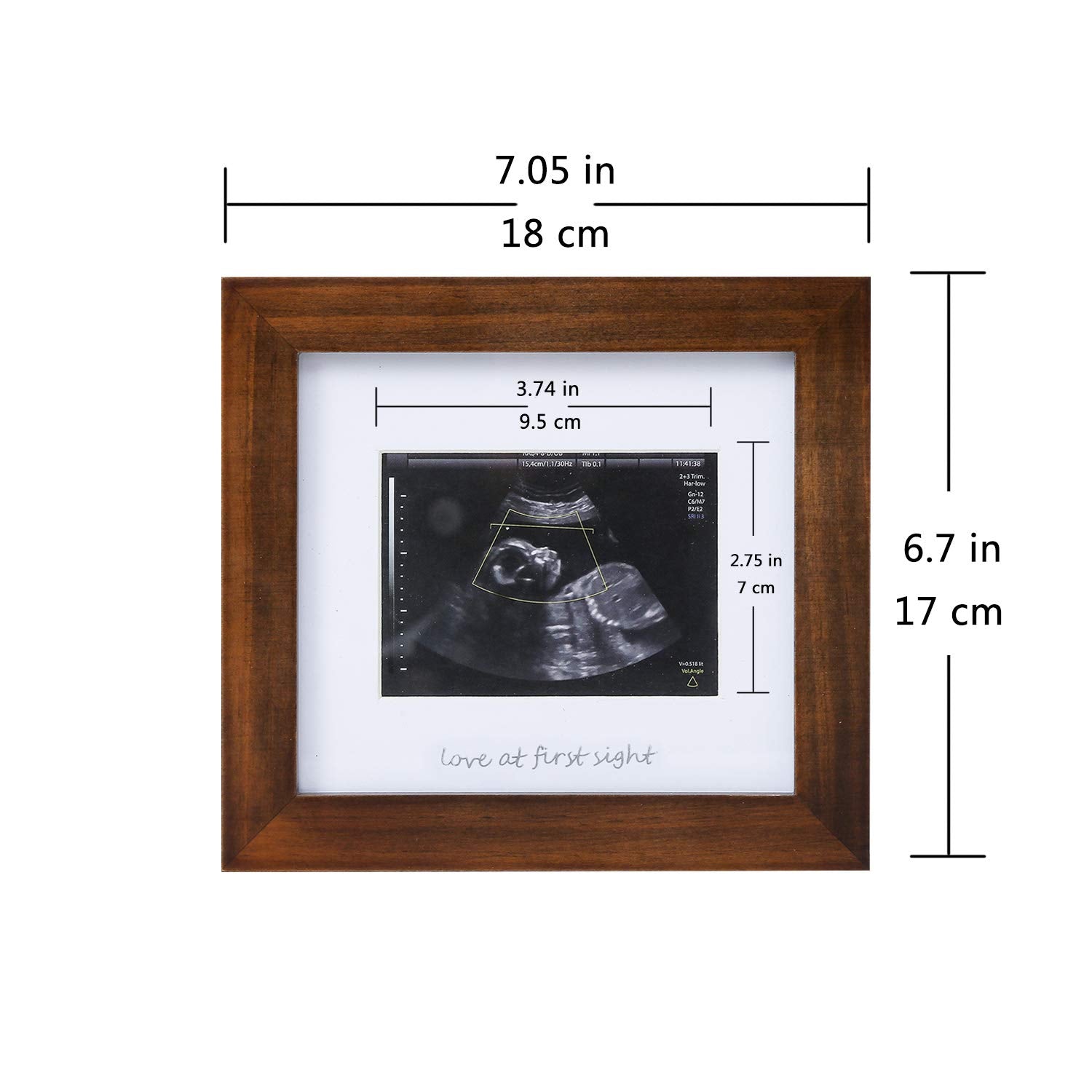 IHEIPYE frame includes three mats for easy display of ultrasound photos
