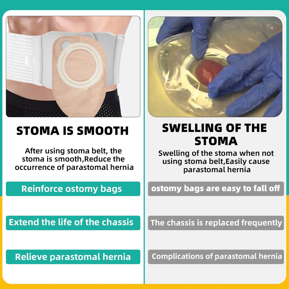 JFHNMLW ostomy belt provides breathable, long-term wear for comfort