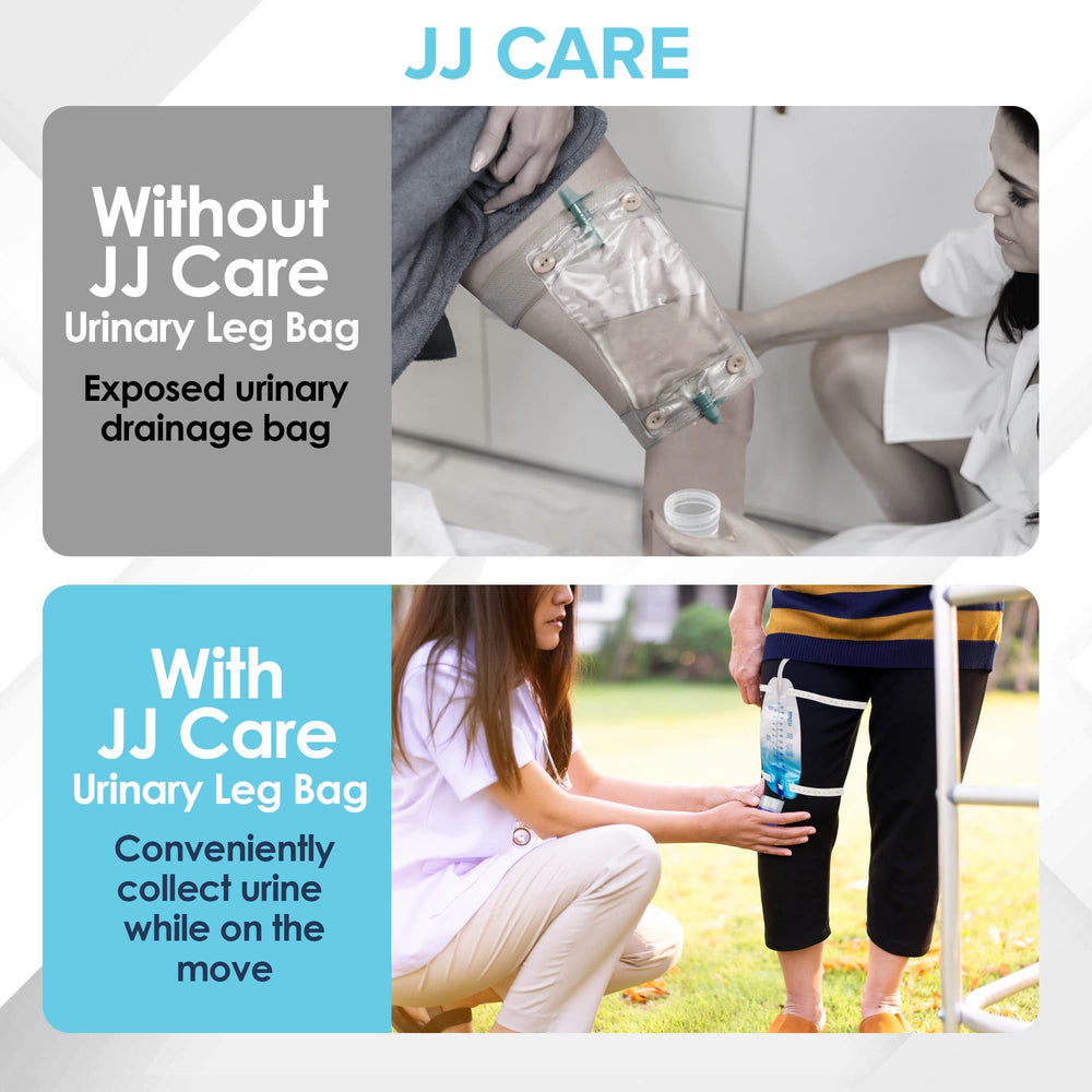 JJ CARE anti-reflux valve on the urinary bag reduces backflow
