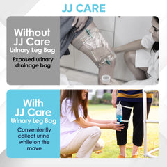 JJ CARE anti-reflux valve on the urinary bag reduces backflow