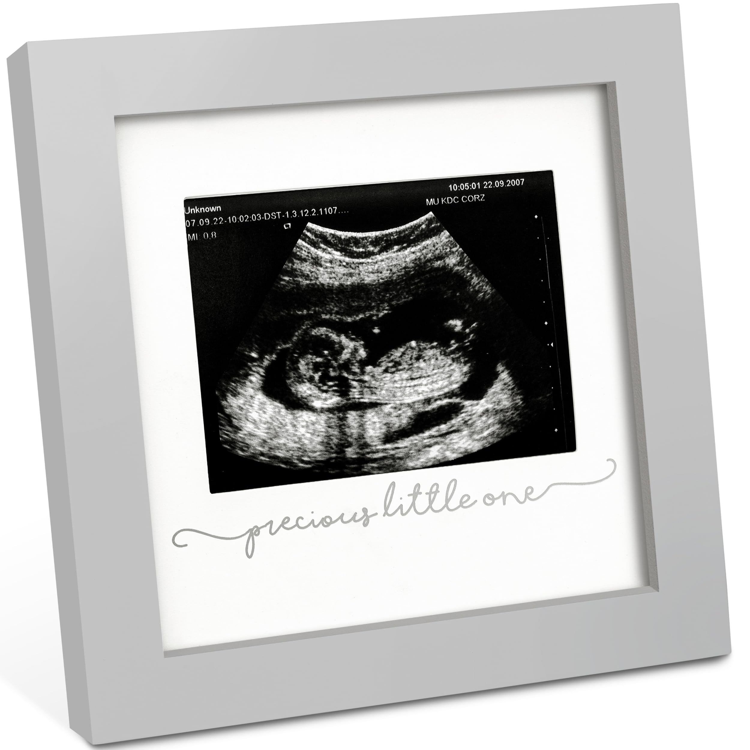 KeaBabies Solo Sonogram Frame with glass cover for a lasting ultrasound keepsake.