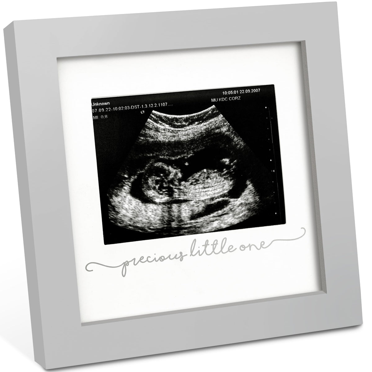 KeaBabies Solo Sonogram Frame with glass cover for a lasting ultrasound keepsake.