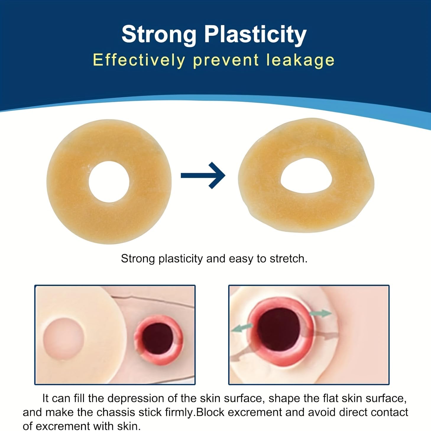 KONWEDA hydrocolloid ring enhancing pouch adhesion and seal
