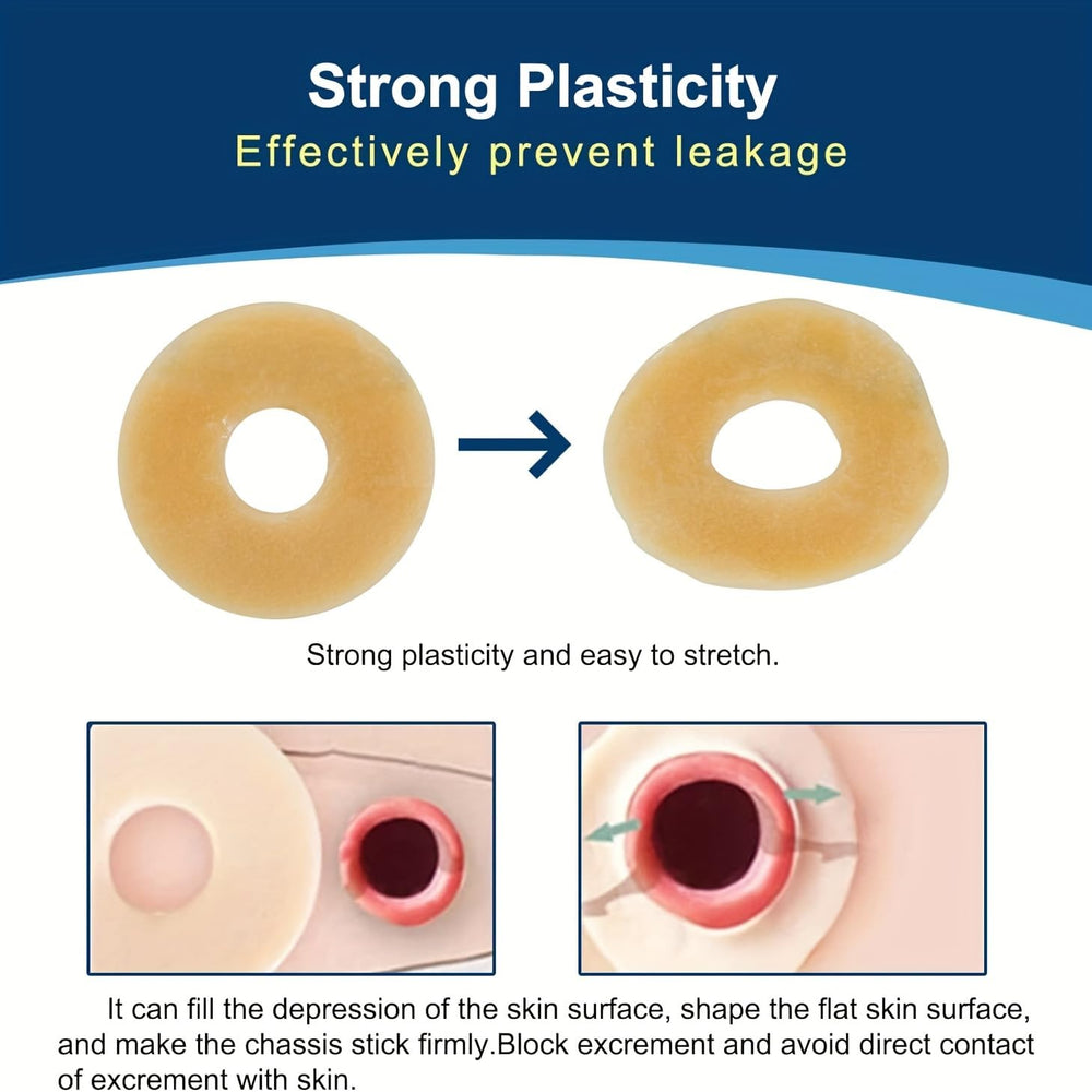 KONWEDA hydrocolloid ring enhancing pouch adhesion and seal