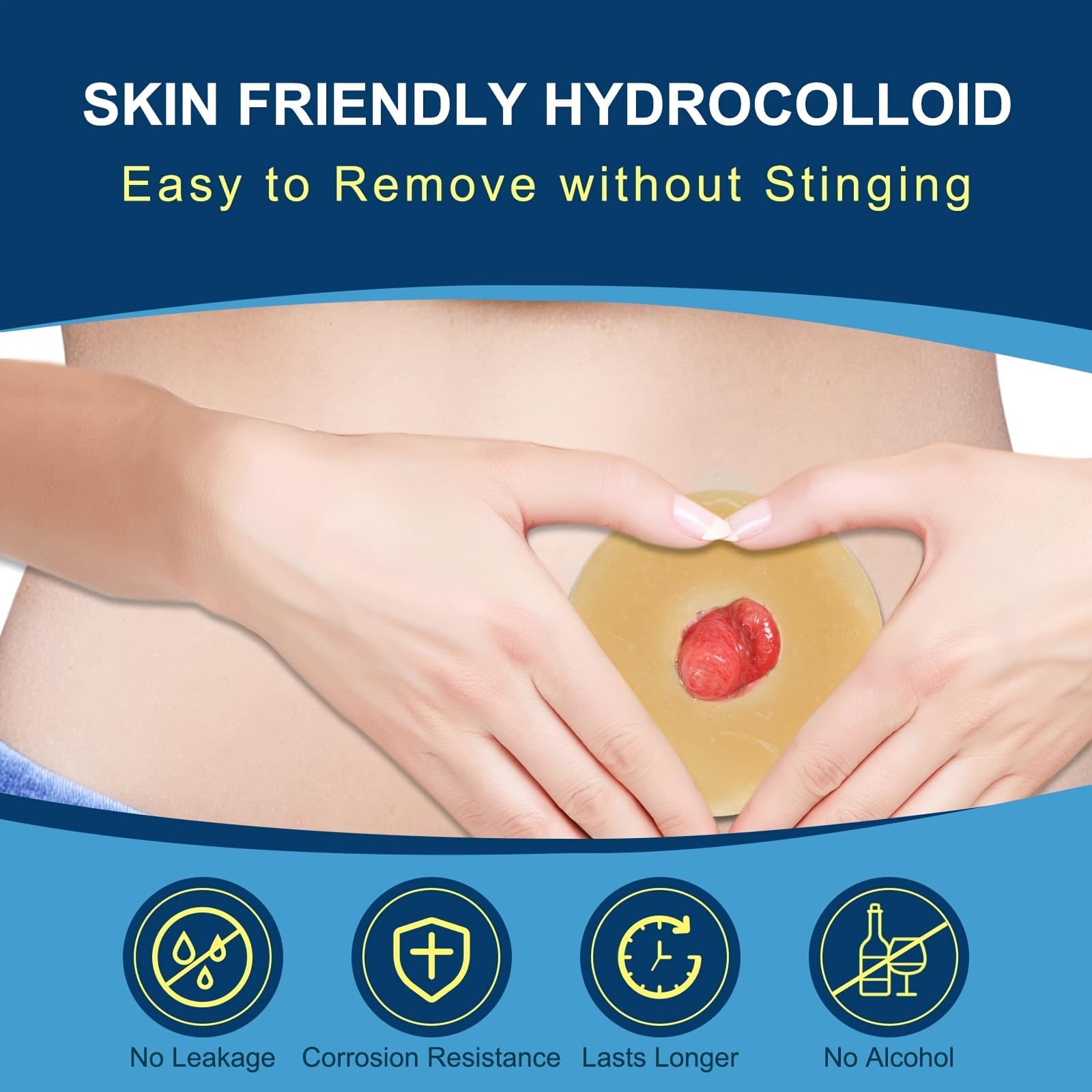 KONWEDA barrier ring shielding peristomal skin from irritation