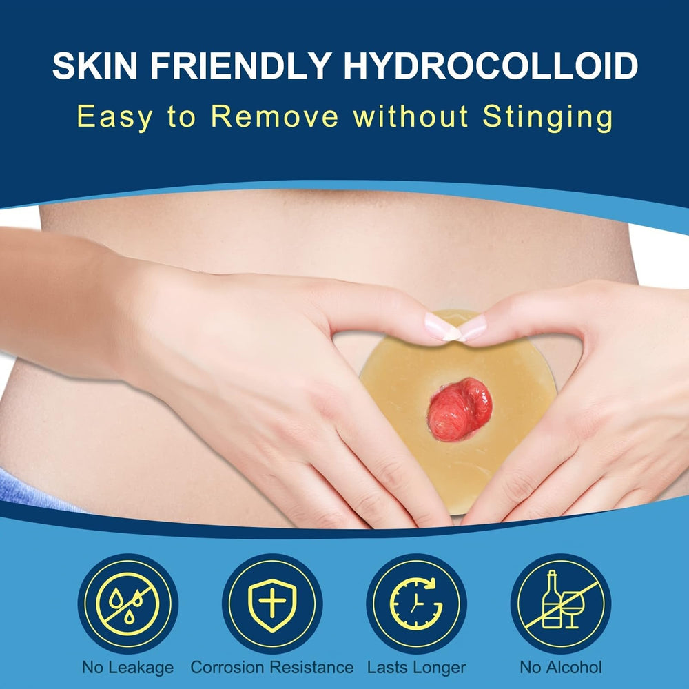 KONWEDA barrier ring shielding peristomal skin from irritation