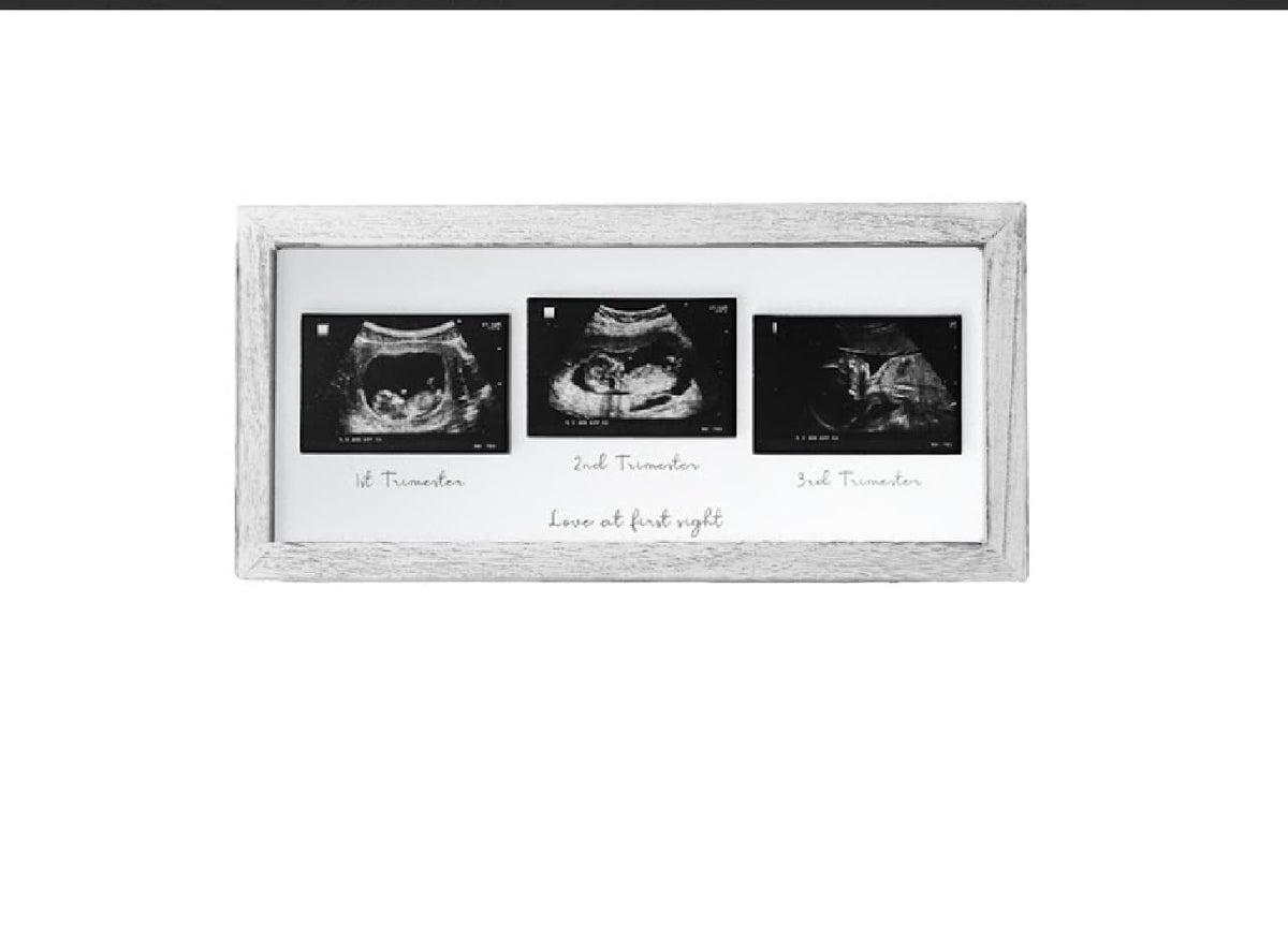 KyNora Rustic White Frame front view, a timeless nursery ultrasound keepsake.