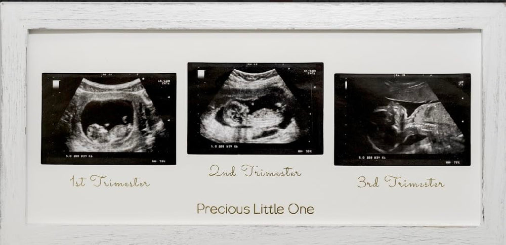 KyNora frame with tabletop stand for easy bedside display.