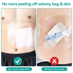 Lefeke adhesive seal close-up highlights strong waterproof seal around the stoma site.