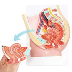 Merinden two-part pelvis model shows removable rectum for interactive learning.