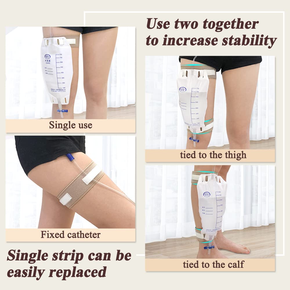 Mistuki dual-use fixation kit keeps bag and catheter securely in place.