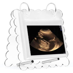Mlatnod Flip Ultrasound Photo Album cover with scalloped acrylic edge for elegant keepsakes.