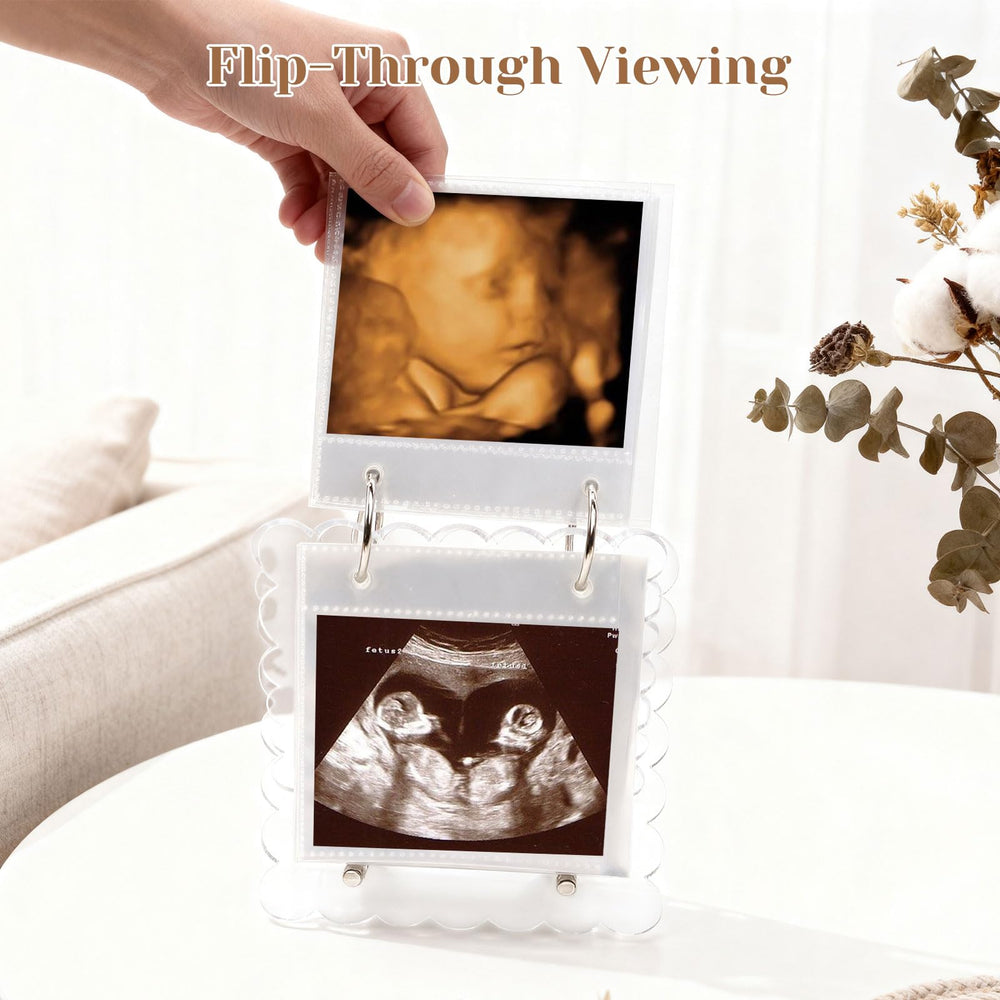 Mlatnod ultrasound photo pages being added and rearranged for easy memory keeping.