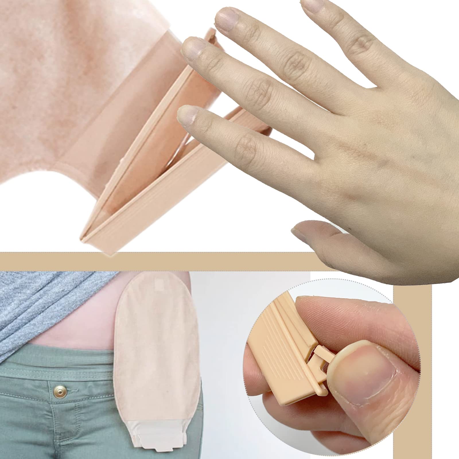 MUROCEA reusable ostomy clip helps reduce leakage risk.