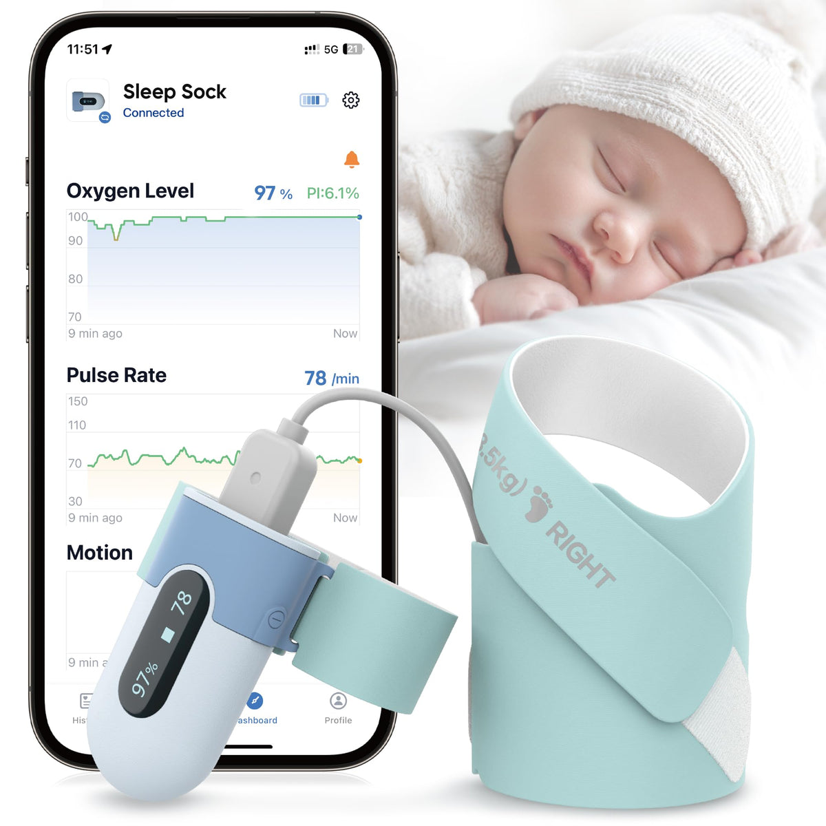 NatEmbrace baby sleep sock monitor worn on the foot for real-time movement tracking.