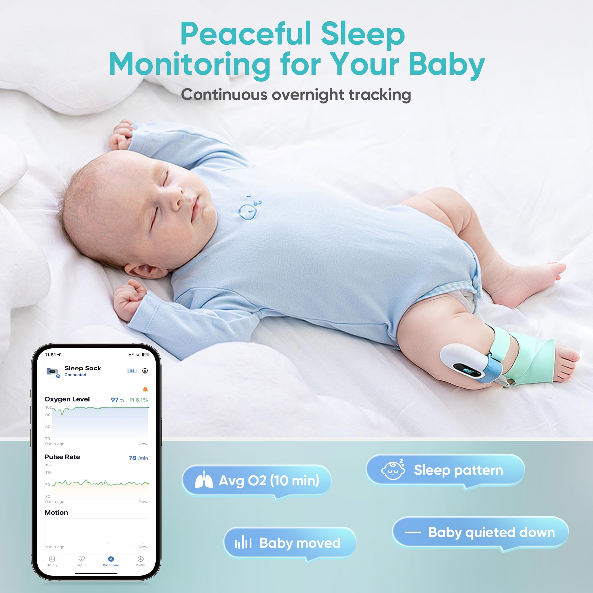Soft hypoallergenic sock preserves delicate baby skin during long monitoring sessions.