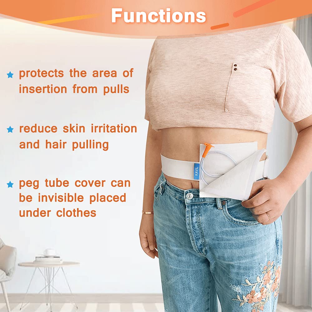 NEPPT abdominal catheter belt supporting PEG and PD catheters