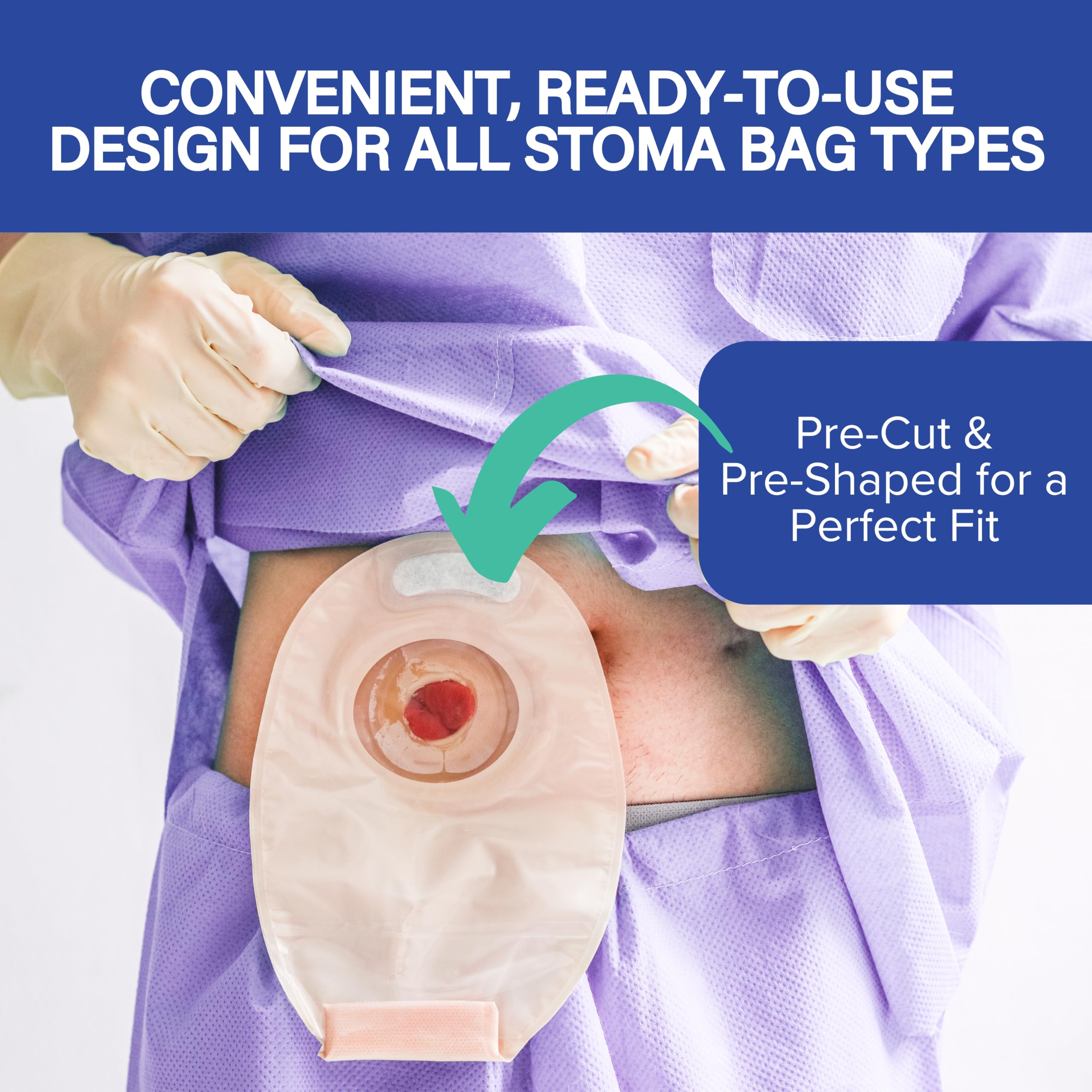 NuBliss universal-fit ostomy bags shown for colostomy, ileostomy, and urostomy compatibility.