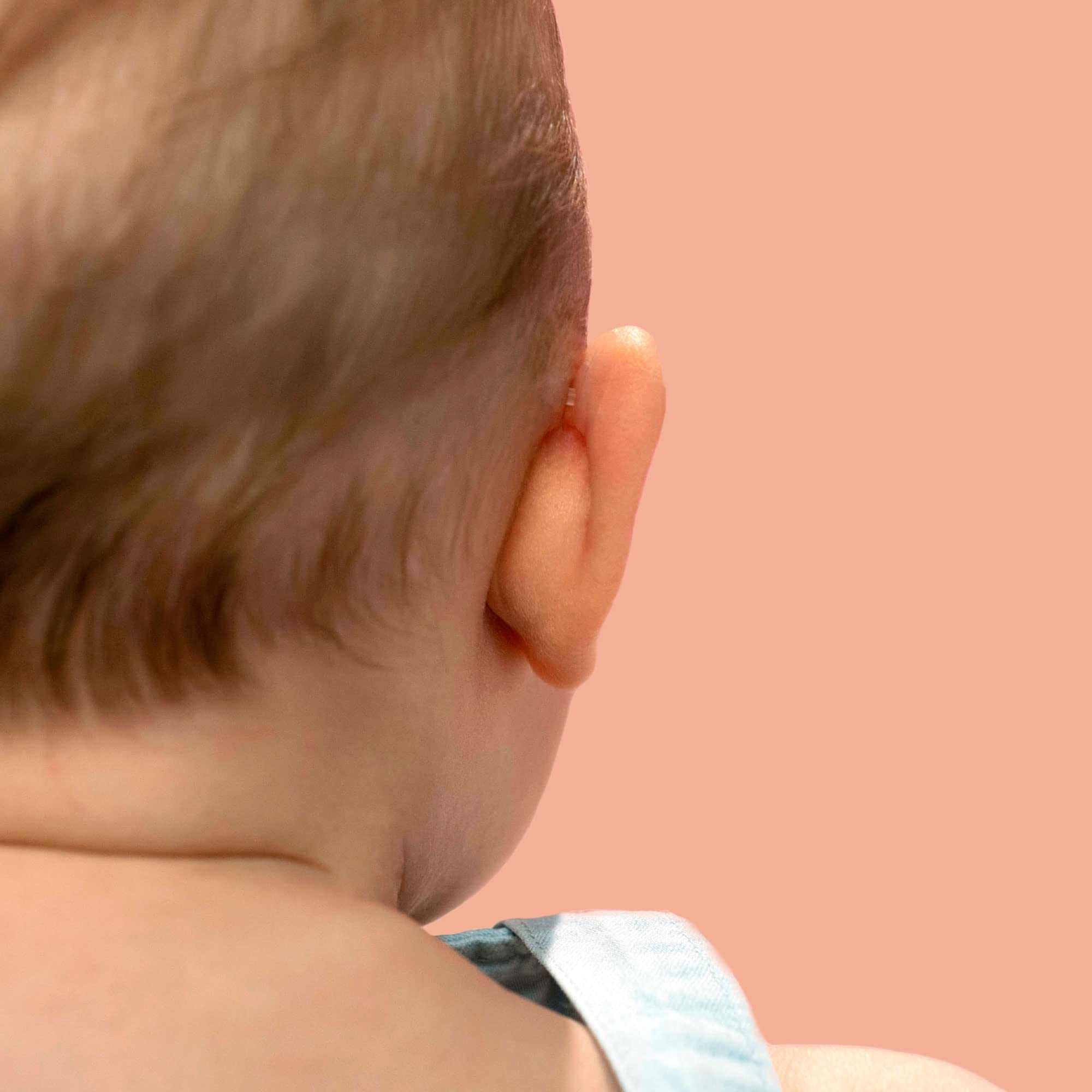 Otostick Baby worn on head for discreet daytime use