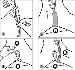 Pakerler daily disposable catheter pack supports hygienic, single-use care.