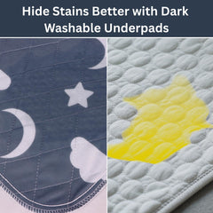Retrona soft top layer reduces irritation for sensitive skin.
