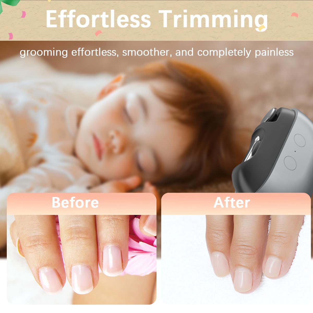 RIMOL 3-in-1 nail trimmer with filing and polishing for a smooth finish