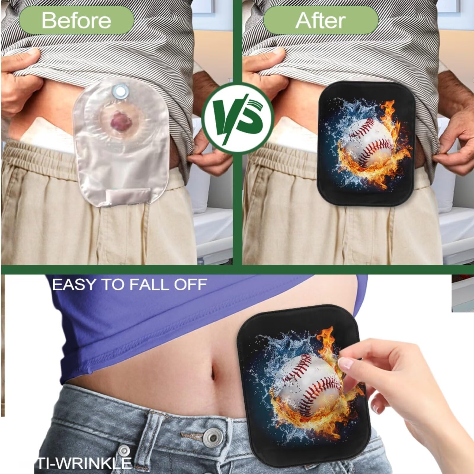 Rnyleeg ostomy bag cover in-use during gym exercise for comfort