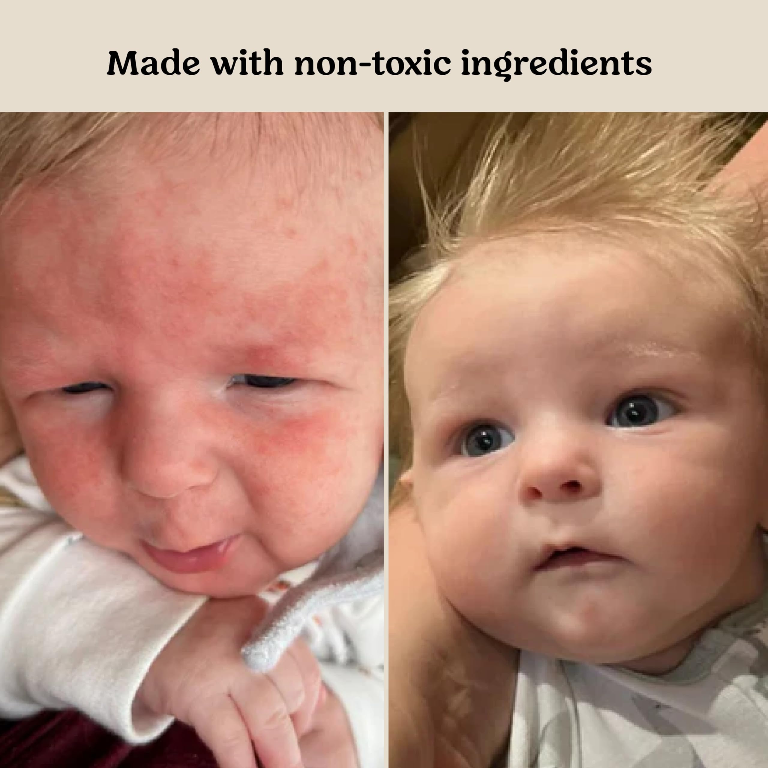 Roe Wellness anti-itch detail suggests soothing relief for irritated areas