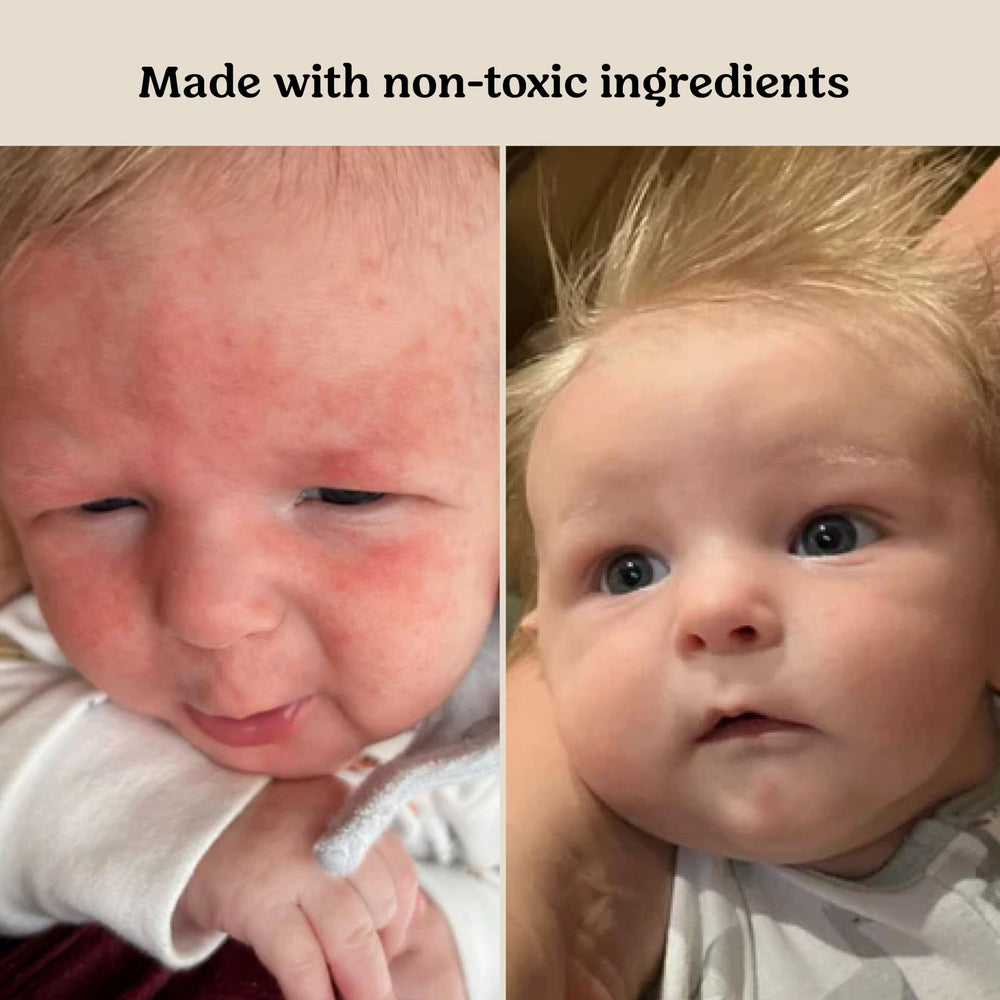 Roe Wellness anti-itch detail suggests soothing relief for irritated areas