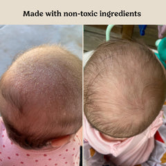 Roe Wellness Baby Oil unscented bottle closeup highlighting lightweight, non-greasy formula.