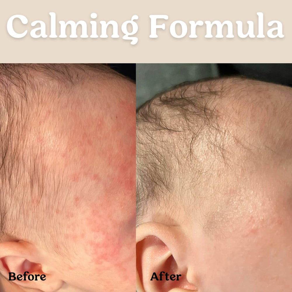 Roe Wellness Baby Oil unscented scalp-hydration emphasizes quick absorption for delicate skin.