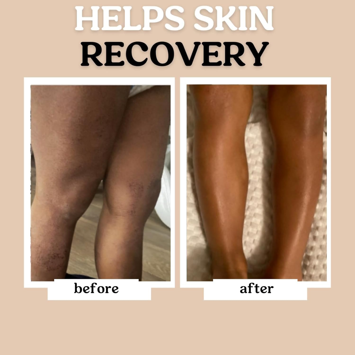 Roe Wellness Baby Oil unscented soft-skin-application captures easy daily moisturization.