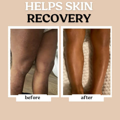 Roe Wellness Baby Oil unscented soft-skin-application captures easy daily moisturization.