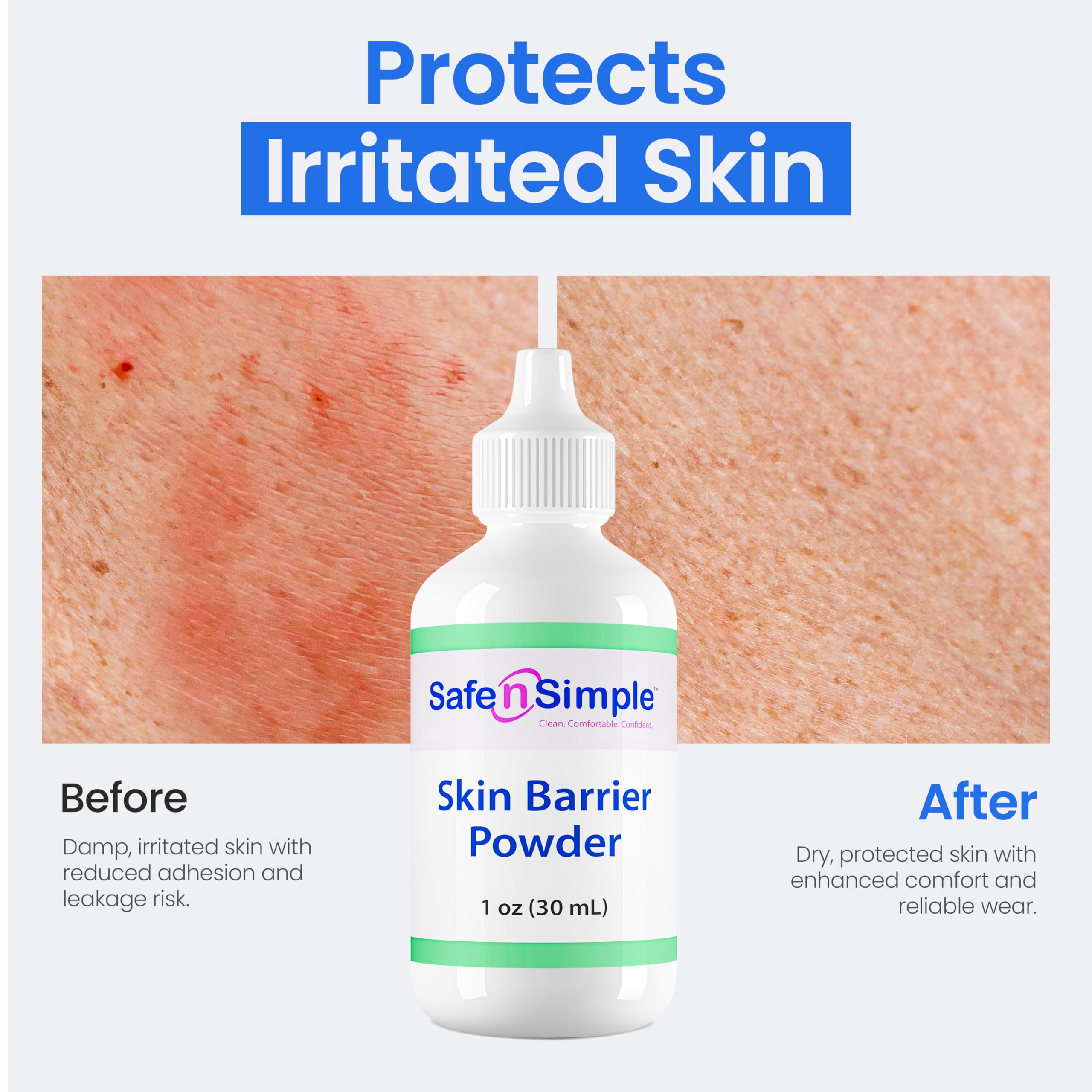 Safe n' Simple skin-care-powder-application aids protective crust and comfort