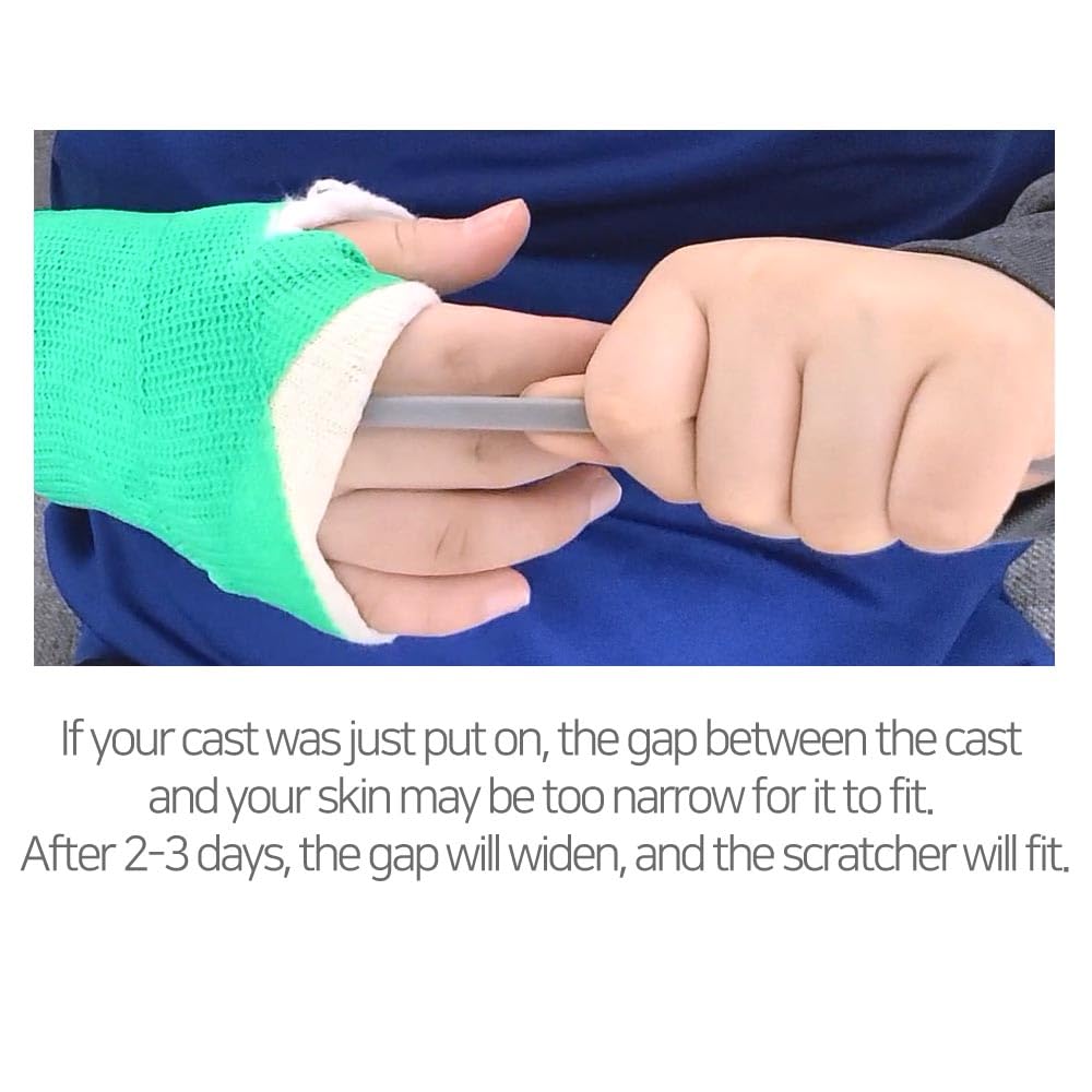 SC SCRATCH 'N' CLEAN use anywhere end helps cleanse and soothe cast areas.