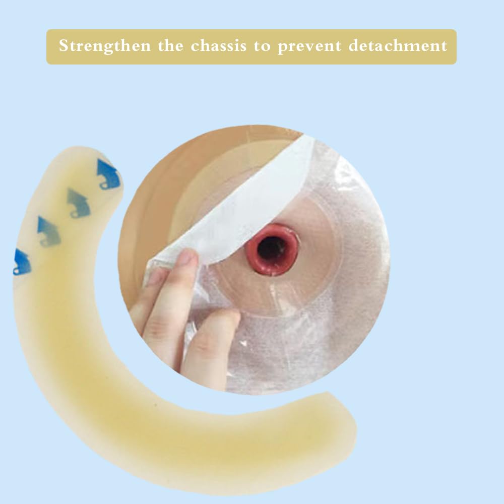 Shanzhinan ostomy barrier strip secures the bag and skin during movement.