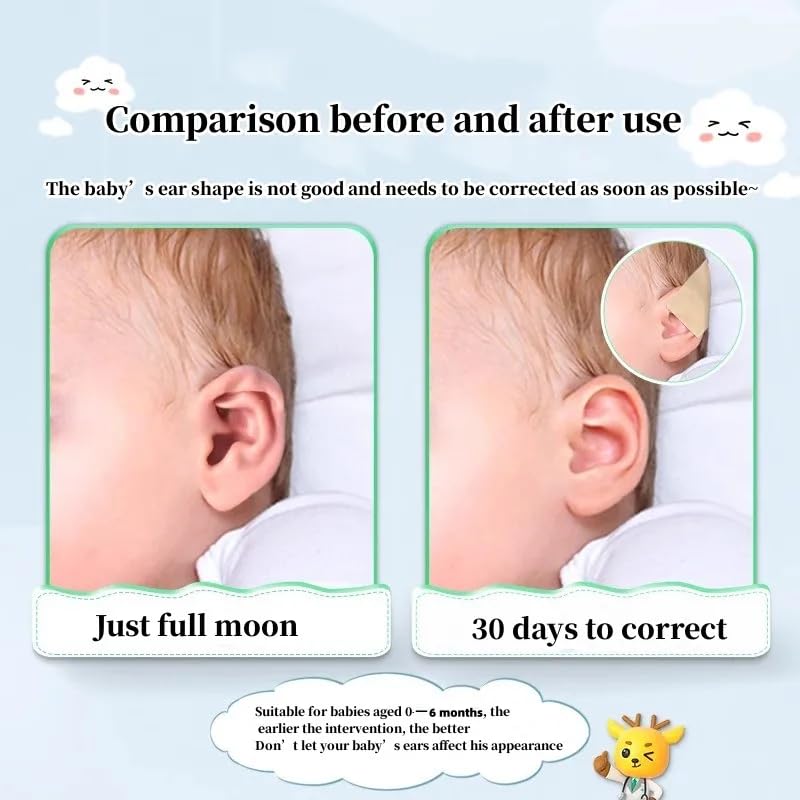 Shenzkeji baby ear fixation adhesive keeps patches securely in place