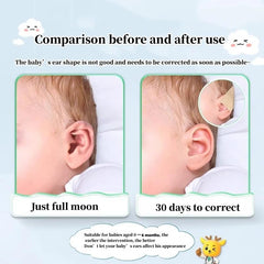Shenzkeji baby ear fixation adhesive keeps patches securely in place
